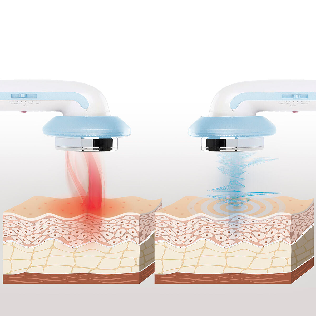 Floreya™ Anti-Cellulite EMS Massager